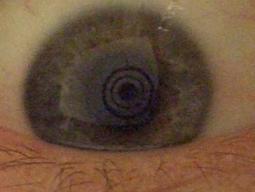 improvisiertes Keratoskop - gesundes Auge (r)